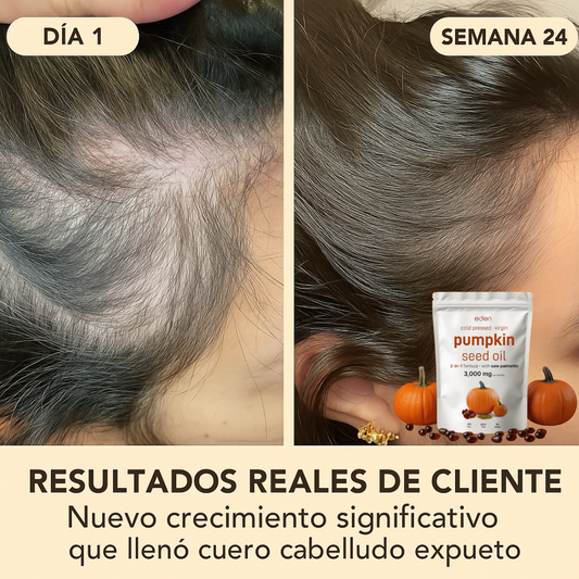 Solucion para la caida del cabello en la menopausia - Capsulas de semilla de calabaza