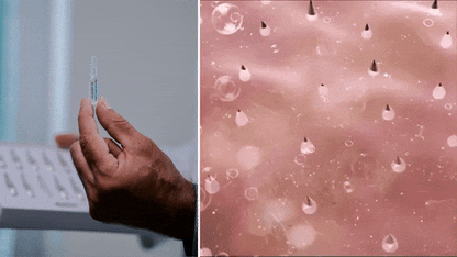 OFERTA 2 X 1 || ¡Haga crecer su cabello nuevamente en 120 días con STEM Cell Complete Hair! - Ampolleta Anticaída y Crecimiento