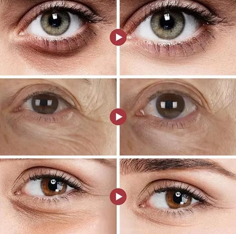 Crema Contorno De Ojos Anti Arrugas con Retinol en Roll On