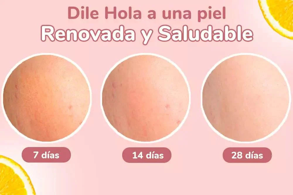 Super Serum 4 en 1 Acala Skin